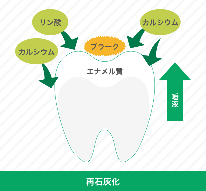 再石灰化